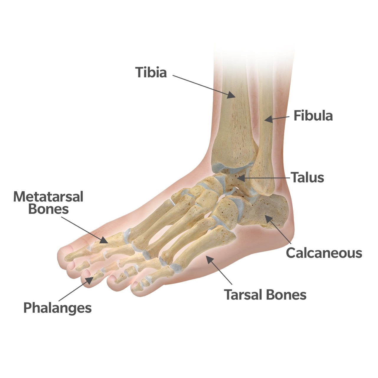 Arthritic bone