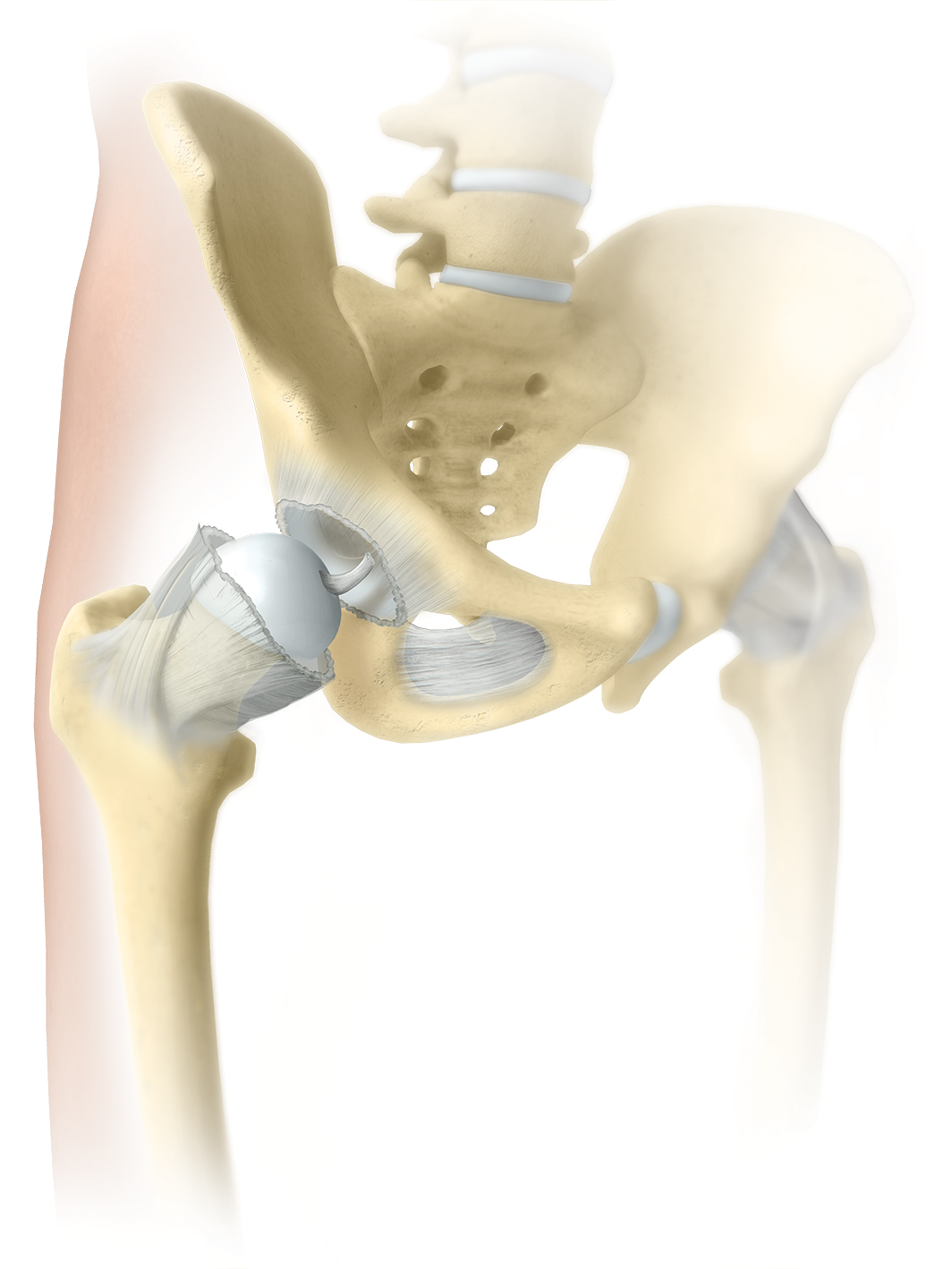 Hip Pain Relief Surgical Treatment Options