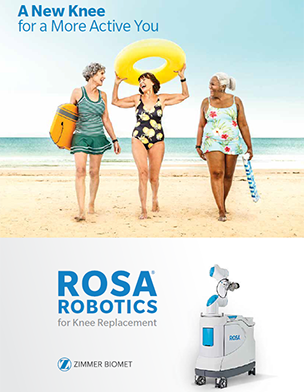 ROSA tka patient brochure